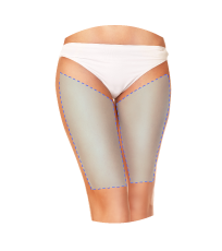 Zonas-mujer-Muslo-anterior